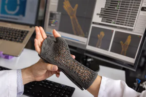 A medical device that fits over the hand like a glove, with fingers exposed.